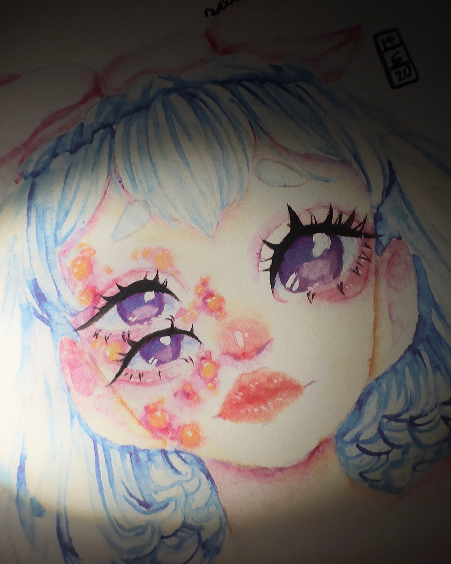 Infected