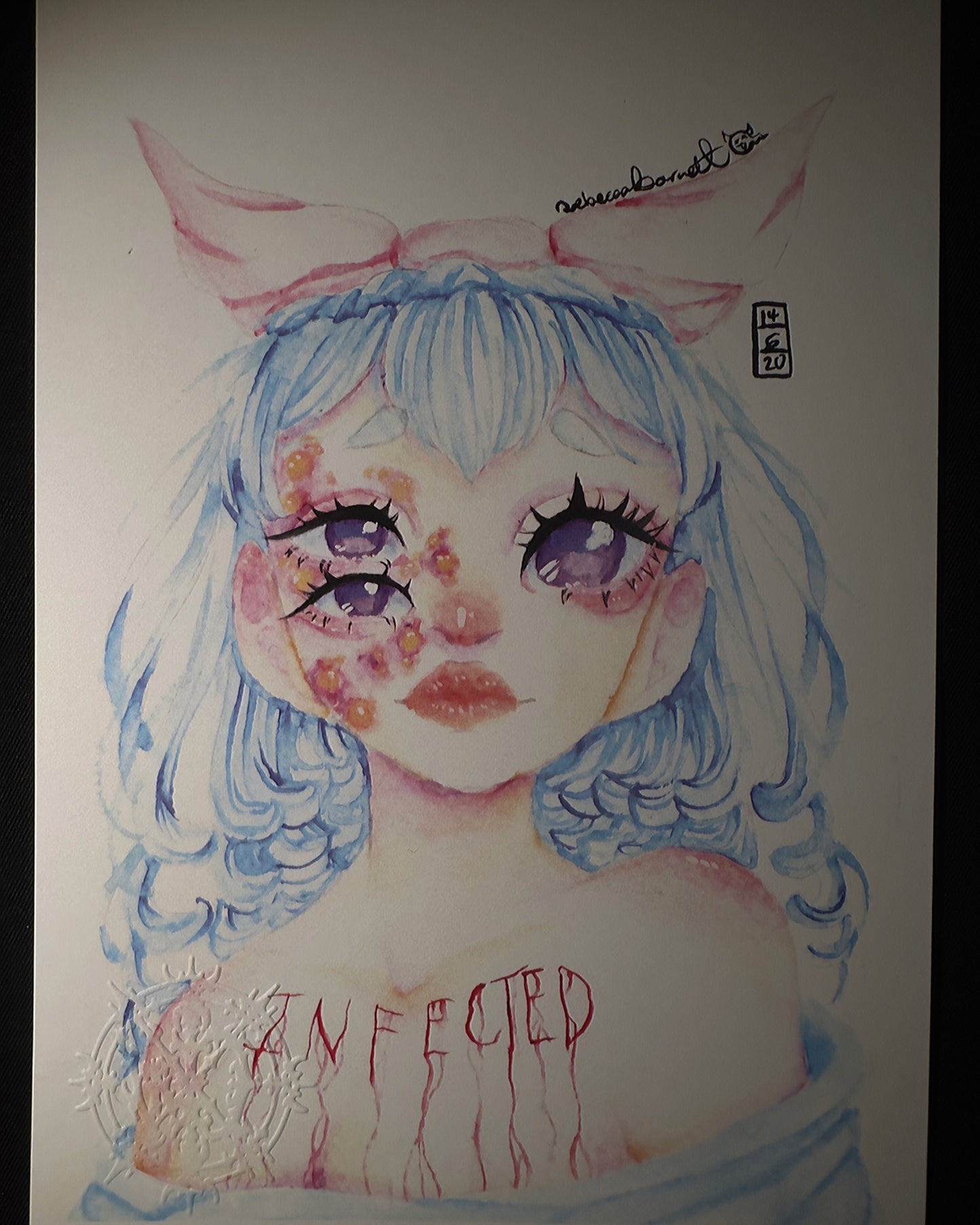 Infected